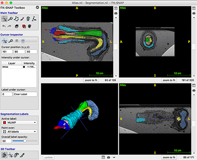 Screenshot of 3D image of adult genitourinary organ.